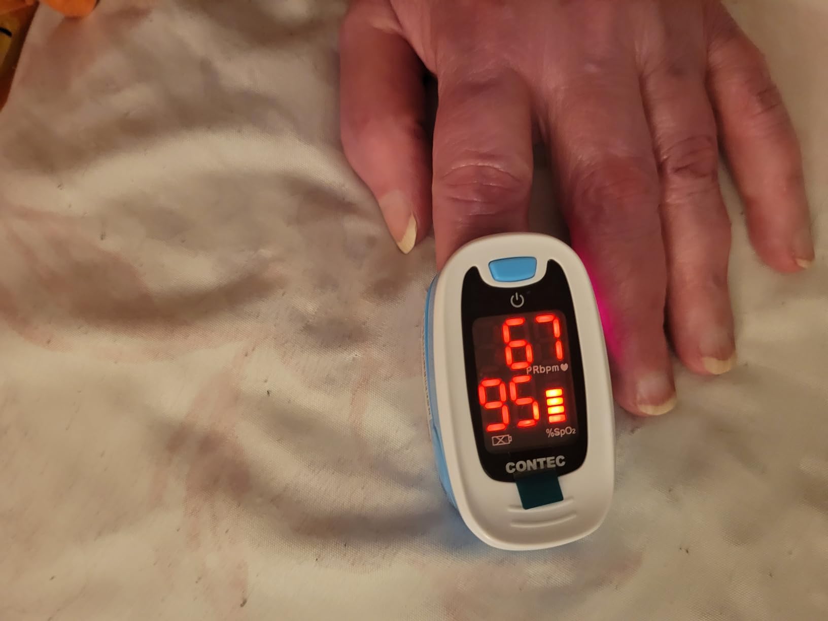 CONTEC Pulse Oximeter, SpO2 & PR Value Blood Oxygen Monitor w/Lanyard customer photo 1