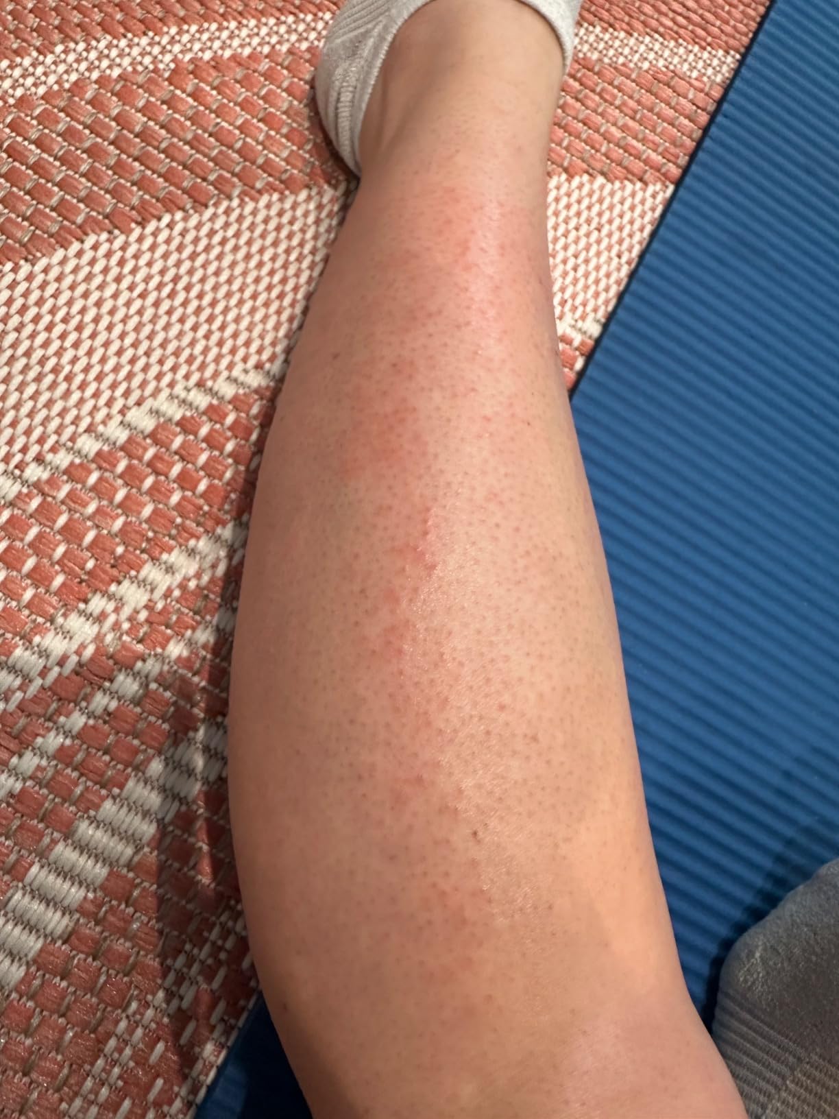 Braun IPL, Silk·Expert Pro 5, IPL Hair Removal for Women and Men, Permanent Laser Hair Reduction At-Home, 2 Heads, Pouch, IPL5137 customer photo 2