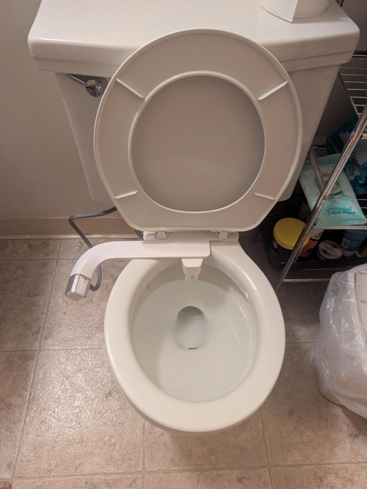 Bidet Dual Mode Bidet Attachment for Toilet(Feminine/Rear Wash) customer photo 1
