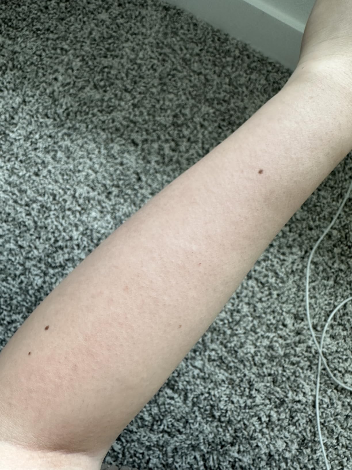 Ulike Laser Hair Removal Device Air 10 Ipl Gift for Women and Men, Ice Cool and Permanent Hair Reduction for Nearly Painless, Dual Lights, Skin Sensor & USHR Mode Hair Removal in 10mins from Home customer photo 1